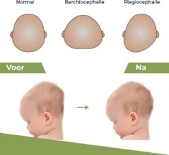Novalits - Orthopedisch Baby Zijslaapkussen Met Traagschuim En Anti-Allergene Bamboe Microvezel Stof Om Een Plat Hoofd Tegen Te Gaan - Zijligkussen Voor Peuter - Babykussen Zijligging - Rolkussen - Steunkussen - Slaapondersteuning -Peuterpaleis Winkel 1200x1103 2