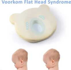 SIMIA™ Ergonomisch Babykussen Met Afneembare Hoes - Tegen Plat Achterhoofd - Hoofdkussen - Traagschuim Kussen - Memory Foam - Baby Steunkussen - Kraamcadeau - Blauw 12 SIMIA™ Ergonomisch Babykussen Met Afneembare Hoes - Tegen Plat Achterhoofd - Hoofdkussen - Traagschuim Kussen - Memory Foam - Baby Steunkussen - Kraamcadeau - Blauw -Peuterpaleis Winkel 1200x1178 10