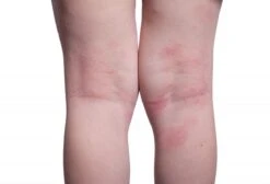 Donttellmum - Eczeem Repair Creme - 50 Ml -Peuterpaleis Winkel 1200x818 1